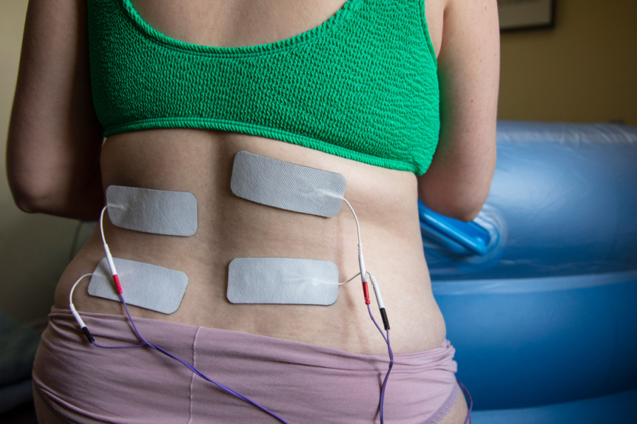 TENS Pain Support Woman with electrodes to her back, experiencing TENS pain support.